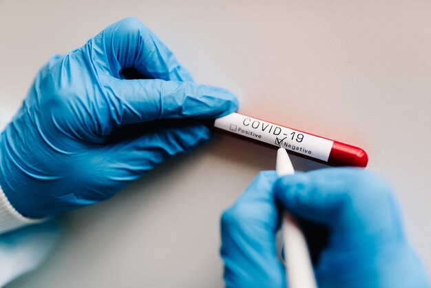 Covid-19 text. A hands of doctor, nurse, scientist writes with a pen and confirms the negative result, hold a test tube with biological sample. Coronavirus.