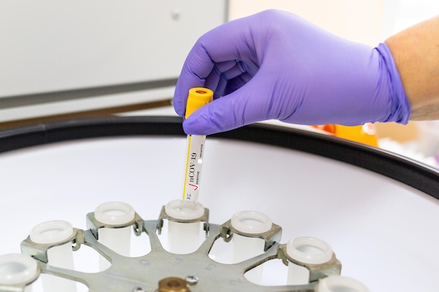 Covid19. un lavoratore in guanti medici mette un campione in una centrifuga da laboratorio, primo piano. concetto di ricerca scientifica e medica del vaccino contro il coronavirus