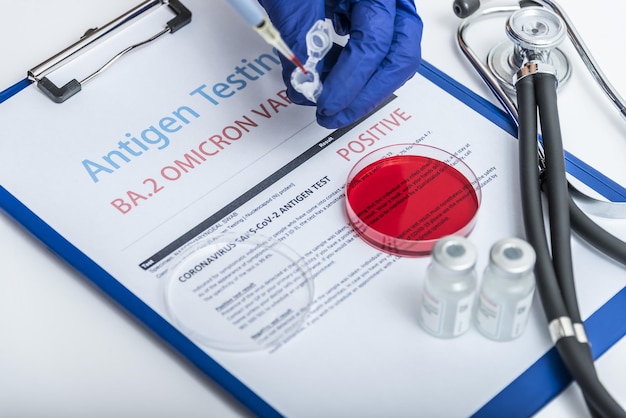 COVID19 swab collection kit in doctor hands nurse in personal protective equipment suit holds tube of coronavirus PCR test Concept of corona virus testing and diagnostics during pandemic