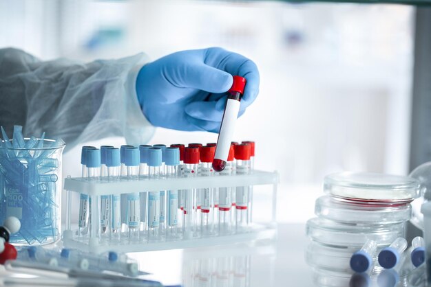 Photo a covid19 vaccine doctors hand holds a bottle with a coronavirus vaccine