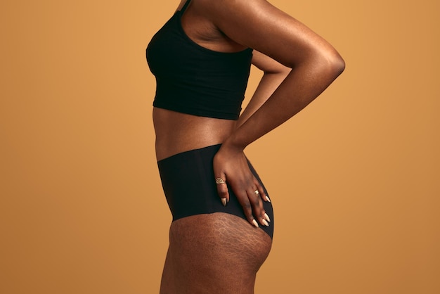 Photo crop black woman with stretch marks on body