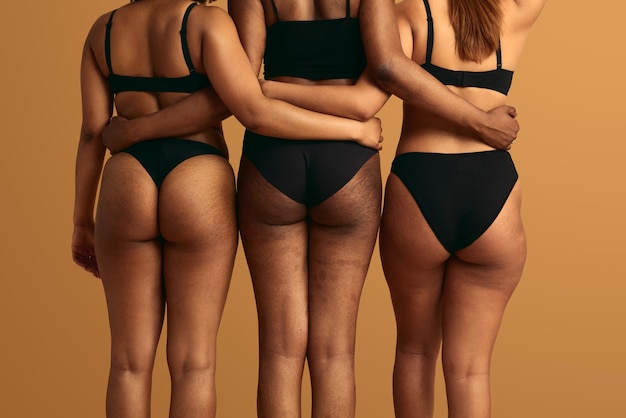 Photo crop multiracial women with stretch marks hugging in studio