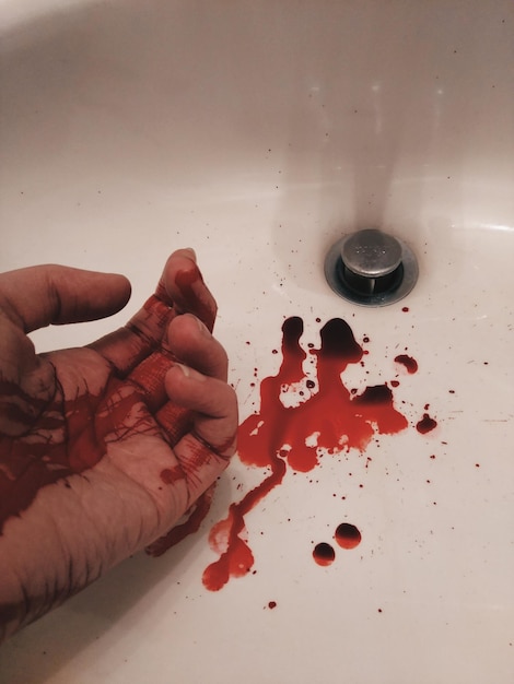 사진 목욕탕에서 피로 인 절단된 손