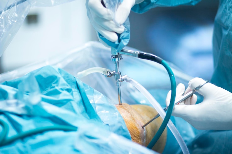 Photo cropped hand of doctor operating patient during knee surgery