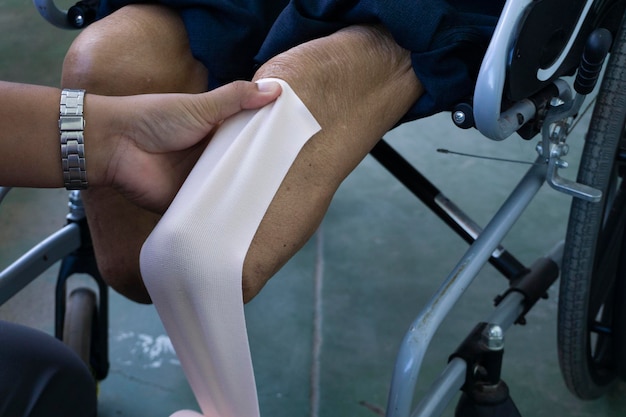 Photo cropped hand of doctor wrapping bandage on prosthesis leg in hospital