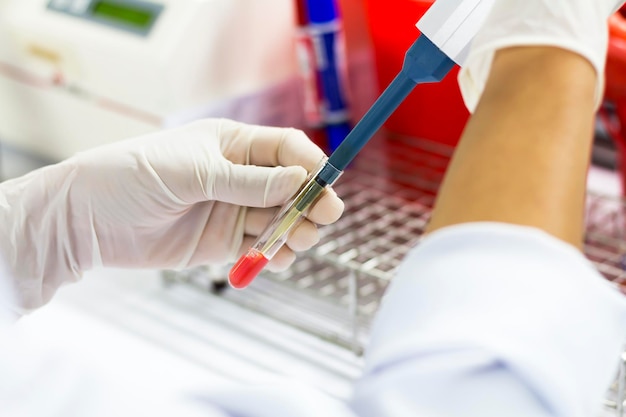 Foto mano tagliata di una persona che pipetta il liquido in un tubo di prova in laboratorio