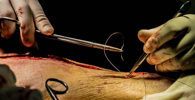 Foto mani tagliate di un dottore che cuce la pelle umana