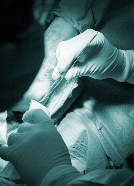 Фото Отрезанные руки врача, выполняющего операцию на колене пациента в больнице