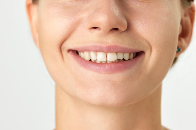 Обрезанное изображение женского лица, улыбки и зубов, изолированных на белом фоне. Зубы - это зубы