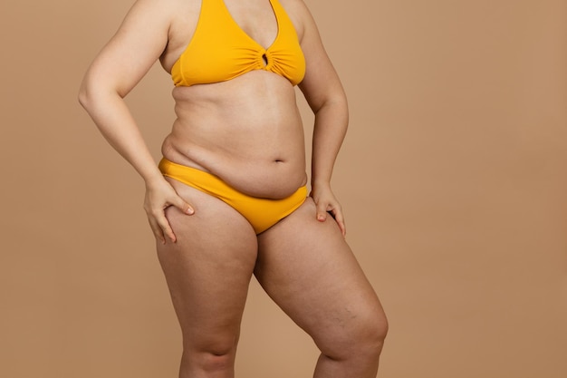 Обрезанное изображение толстой голой женщины с ожирением, избыточным жиром на бедрах в желтом купальнике. Большой размер, держащий бедра, висцеральный целлюлит.