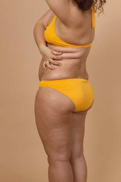 Cropped image of overweight fat woman with obesity hips excess fat in yellow swimsuitholding waist flabs liposuction