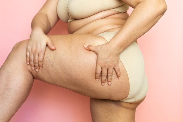 Cropped image of overweight woman sag hips buttocks with obesity excess fat in lingerie Squeezing cellulite thigh