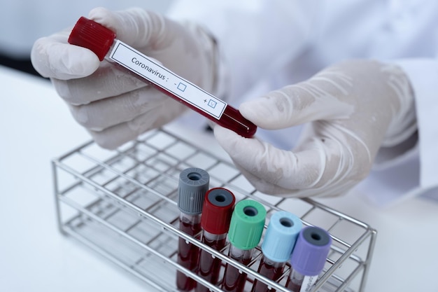 Photo cropped image of person holding blood sample