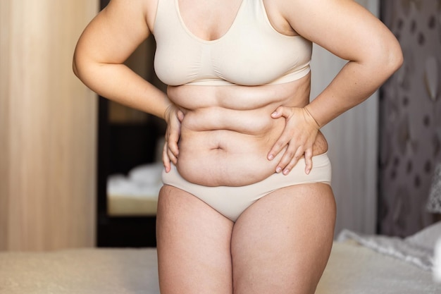 Photo cropped of overweight woman holding tummy flabs with obesity excess fat in underwear adipose stomach emphasizing fat
