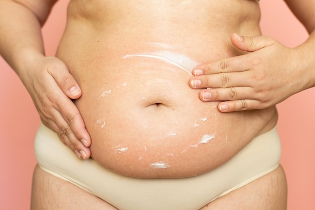 Cropped overweight woman in underwear rubbing moisturizer cream lotion to her abdomen Belly fat removal Postnatal