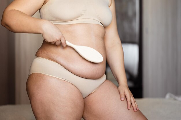 Female hanging belly with stretch marks on skin closeup. Overweight woman  flaunt figure Stock Photo by burmistrovaiuliia