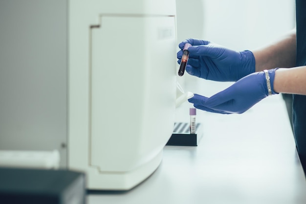 ゴム手袋をはめた手のトリミングされた写真は、専門の実験室の血液分析装置に試験管を注意深く配置します
