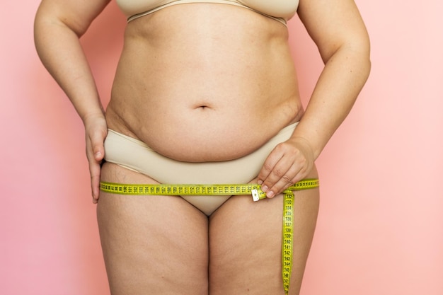 Cropped photo of naked overweight woman body holding and\
measuring by tape her large hips buttocks fat dispropotion