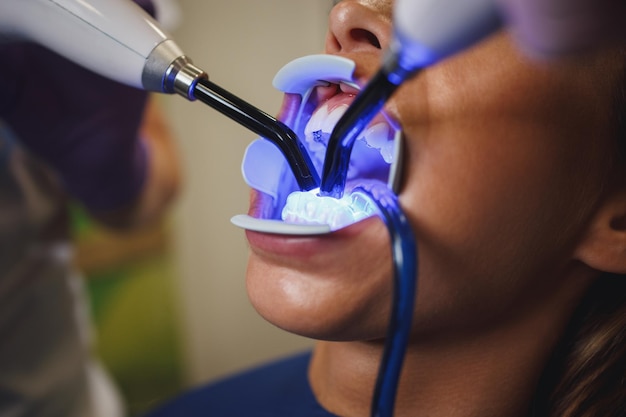 아름다운 젊은 여성의 자른 샷이 치과에 있습니다. 그녀는 치과 의사의 의자에 앉았고 치과 의사는 치료용 빛으로 그녀의 치아에 설측 잠금 장치를 고정했습니다.