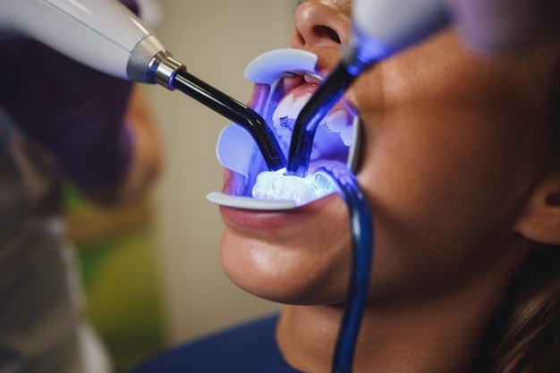 Photo cropped shot of a beautiful young woman is at the dentist. she sits in the dentist's chair and the dentist fixed lingual locks on her teeth with curing light.