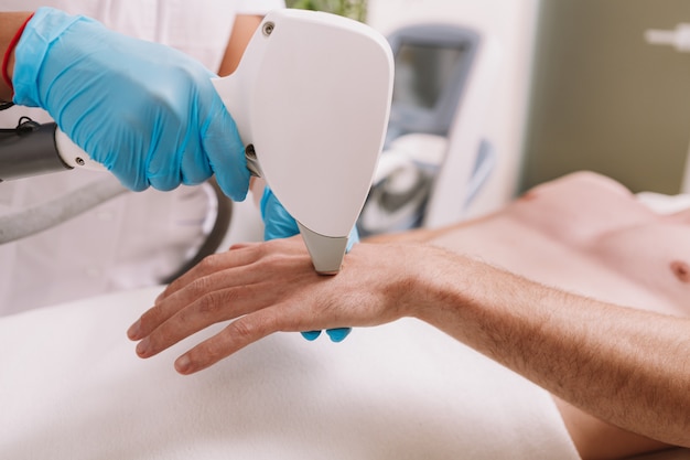 Cropped shot of a cosmetologist removing hair on the hand of a male client, using laser hair removal device