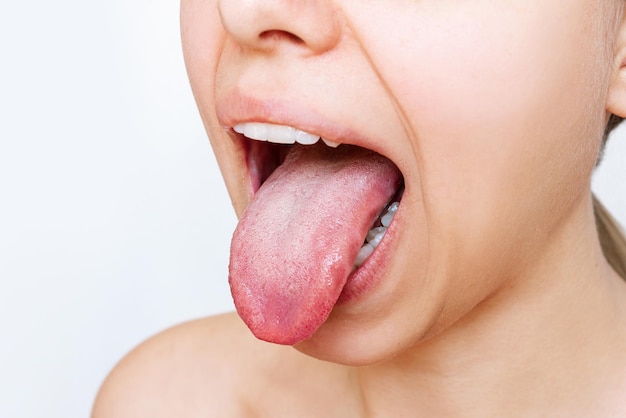 Cropped shot of a young woman showing tongue with a white plaque isolated on a white background