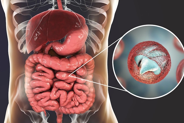 Photo cryptosporidiosis a diarrheal disease caused by cryptosporidium parvum protozoan 3d illustration showing release of parasite sporozoites from oocyst inside small intestine