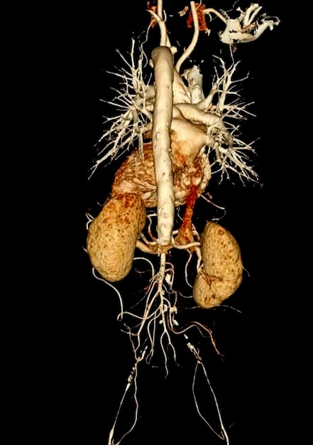 CT angiography for diagnosis of vascular disease trauma. Angiogram of whole body. medical Concept.