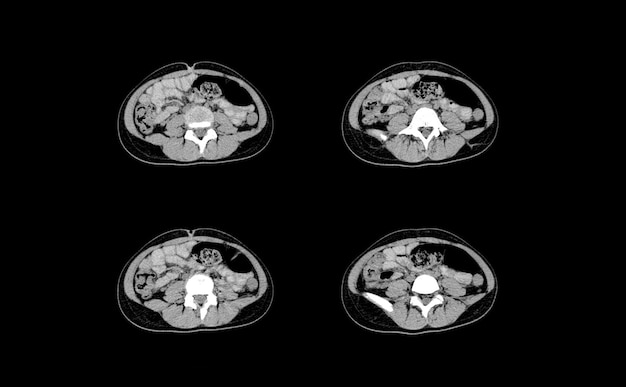 Ct Scan en MRI Abdomen professionele beelden