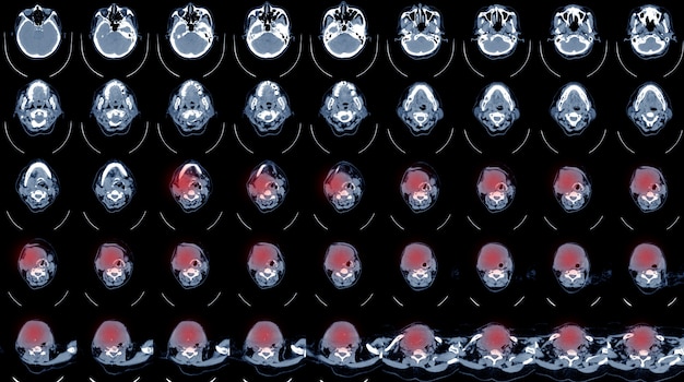 CT-SCAN VAN DE HALSGESCHIEDENIS