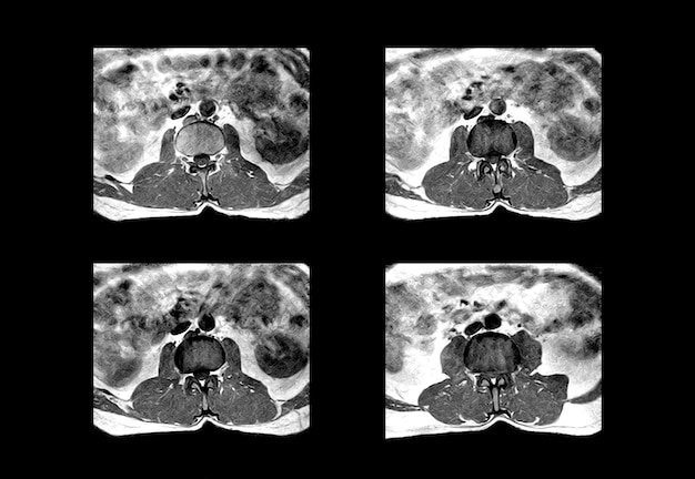 CT-scan van de onderste wervelkolom en professionele MRI-beelden