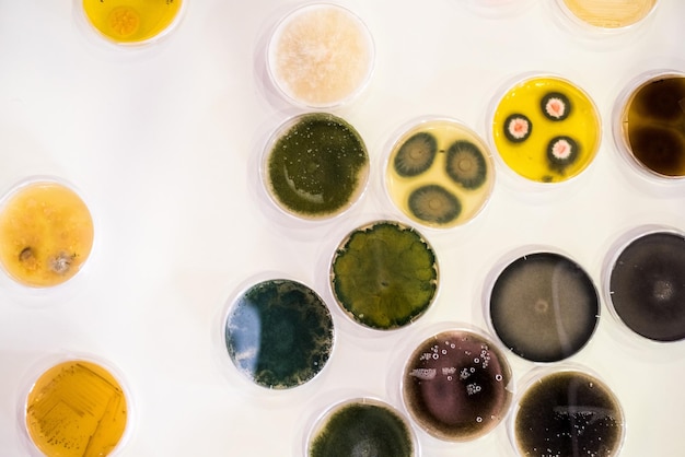 페트리 접시에서 박테리아의 문화