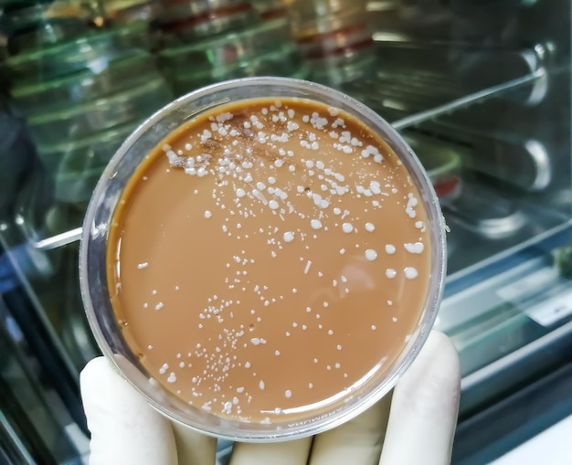 Photo culture media plate or petri dish with bacterial colony in microbiology department