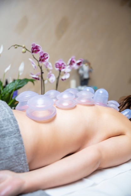 Photo cups applied to back skin of a female patient as part of the traditional method of cupping therapy