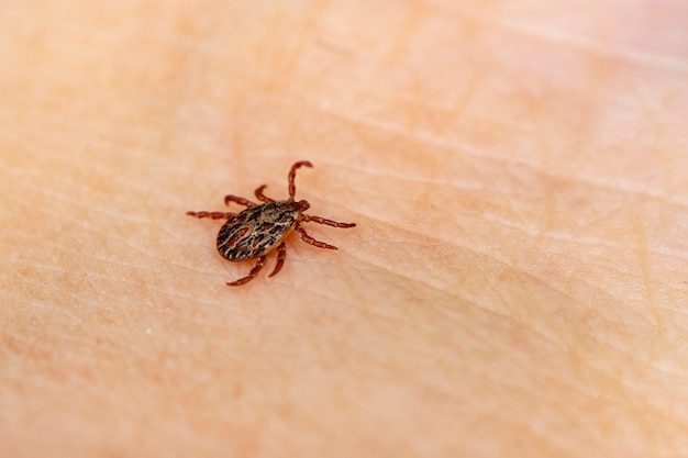 危険な吸血昆虫。小さな茶色の斑点のあるダニ、生物学的名称は人間の皮膚にあるDermacentormarginatus。