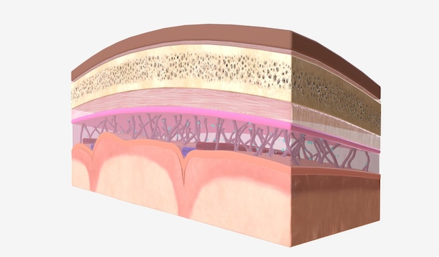 De afname van de intracraniale druk