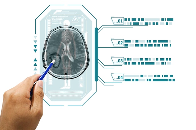 De arts wijst op beelden van de hersenen met abnormale aandoeningen zoals tumoren of bloedingen in de hersenen medisch beeldconcept