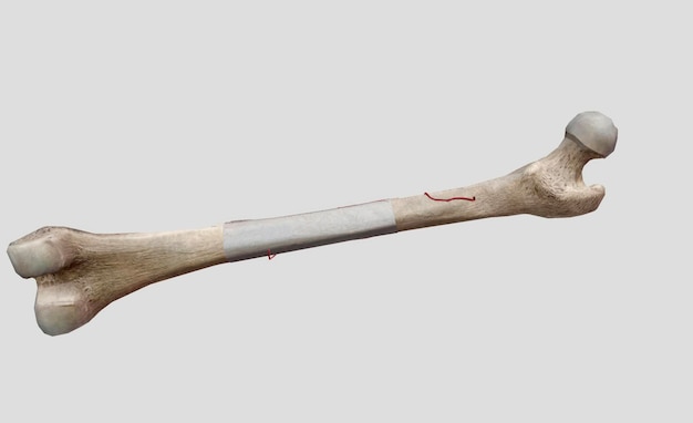 Foto de dwarsdoorsnede van het dijbeen