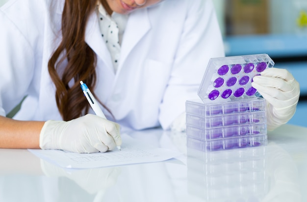 Foto de hand van de wetenschapper houdt de plaat van de test van knokkelkoortsvirussen in laboratorium