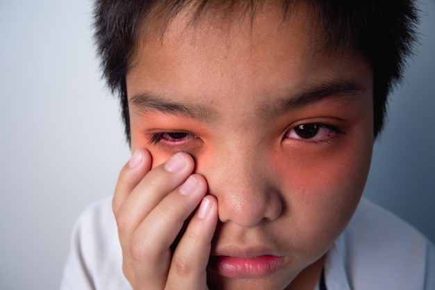 De jongen doet pijn aan zijn ogen Hij drukt met zijn vingers op zijn oog Dit schot is een close-up portret In rode kleur toont het de positie van symptomen