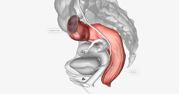 Foto de laatste twee delen van de dikke darm of colon zijn de sigmoïde colon en het rectum