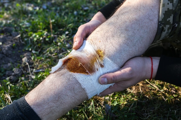 De mens zet verband op bloedende wond. Gewond been. Toerist in de natuur. Infectiegevaar. Medische behandeling. Wandeltrauma.