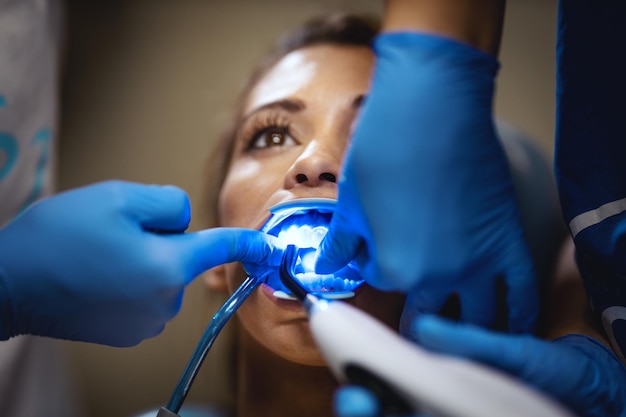 De mooie jonge vrouw is bij de tandarts. Ze zit in de tandartsstoel en de tandarts zet een beugel op haar tanden en plaatst esthetische zelfuitlijnende linguale lokken met een infraroodlamp.