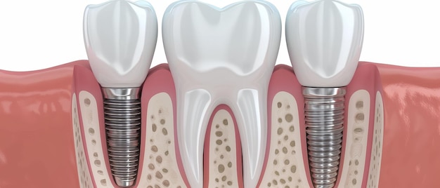 Photo debunking common dental care myths educational informative