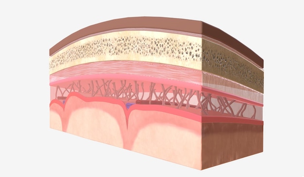 Photo the decrease in intracranial pressure