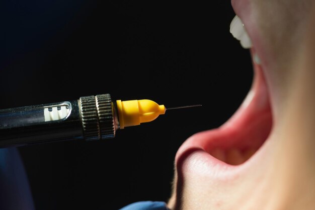 Photo dental anesthesia