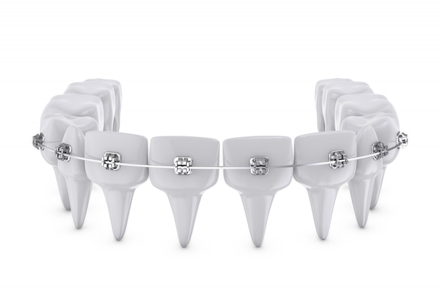 Photo dental brackets