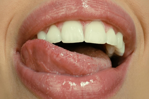 사진 치과 치료 건강한 치아와 하얀 건강한 치아 o와 미소의 입 근접 촬영에 하얀 치아 미소