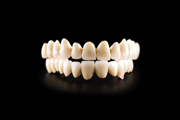 Dental ceramic bridge on isolated black  