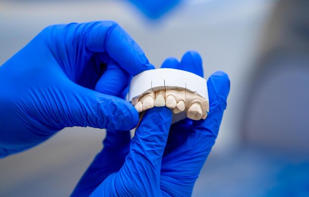 Foto dentale una protesi dentale lucida denti artificiali protesi protesi mani mentre si lavora sulla protesi denti falsi primo piano